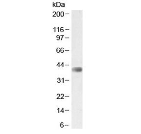 Western blot testing of mouse skeletal muscle lysate with CDK9 antibody at 2ug/ml. Predicted molecul