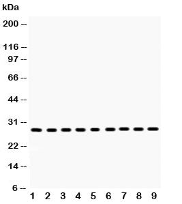 Western blot testing of PRDX3 antibody and Lane 1: rat brain; 2: mouse brain; 3: rat skeletal muscle