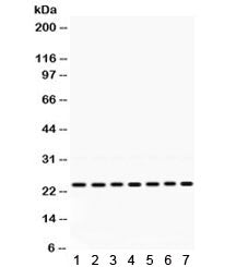 Western blot testing of rat 1) brain, 2) thymus, 3) testis, 4) mouse thymus, 5) mouse liver, 6) huma