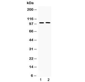 Western blot testing of 1) rat lung and 2) human PANC1 lysate with PDE5A antibody at 0.5ug/ml. Predi