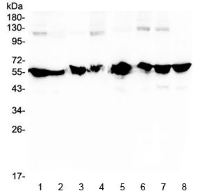 Western blot testing of human 1) HeLa, 2) placenta, 3) MCF7, 4) A549, 5) SW620, 6) PANC-1, 7) U-2 OS