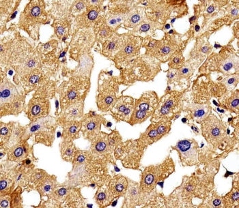 IHC testing of FFPE human liver tissue with HBG2 antibody. HIER: steam section in pH6 citrate buffer