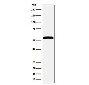 Western blot testing of human Jurkat cell lysate with Membrane Palmitoylated Protein 1 antibody. Exp