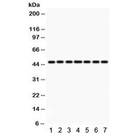 IDH1 Antibody