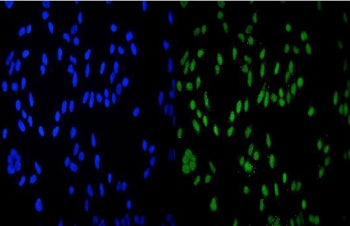 Immunofluorescent staining of FFPE human HeLa cells with HDAC9 antibody (green) and DAPI nuclear sta