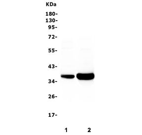 Western blot testing of 1) rat skeletal muscle and 2) mouse skeletal muscle with TNNT3 antibody. Pre