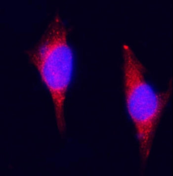 Immunofluorescent staining of FFPE mouse RM1 cells with Plagl1 antibody (red) and DAPI nuclear stain