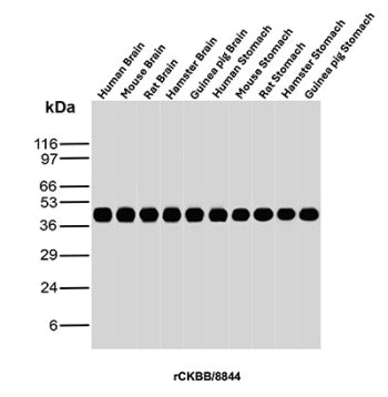 Western blot analysis of Human Brain, Mouse Brain, Rat Brain, Hamster Brain, Guinea pig Brain, Human
