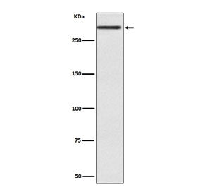 Western blot testing of human fetal kidney with Cubilin antibody. Expected molecular weight: 399-460