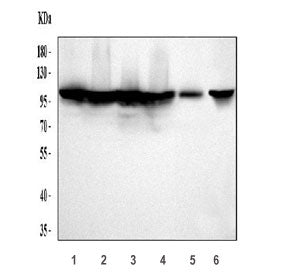 Western blot testing of 1) huma HeLa, 2) human 293T, 3) human LNCaP, 4) human MCF7, 5) rat NRK and 6