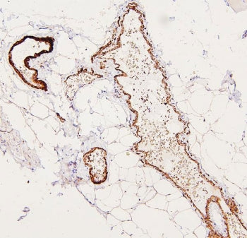 Filamin A Antibody / FLNA