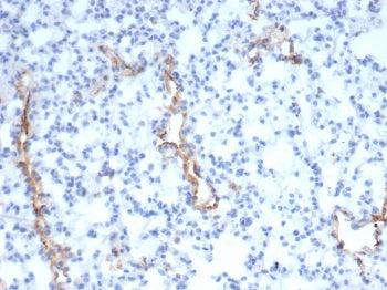 IHC staining of FFPE mouse lung with vWF antibody (clone VWF/4105). HIER: boil tissue sections in pH