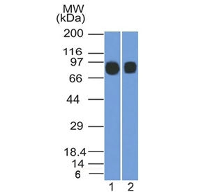 Western blot testing of human 1) Raji and 2) Ramos cell lysate with CD10 antibody (clone MME/1892). 