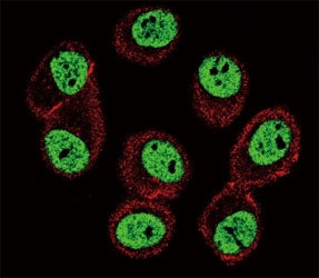Confocal immunofluorescent analysis of BMI1 antibody with MCF-7 cells followed by Alexa Fluor 488-co