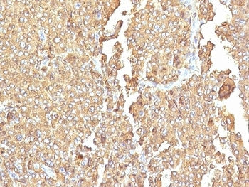 IHC: Formalin-fixed, paraffin-embedded human adrenal gland stained with Chromogranin A antibody (LK2
