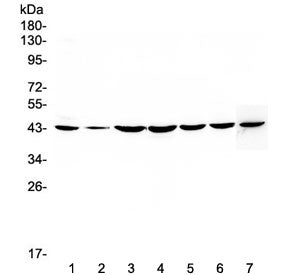 Western blot testing of human 1) HeLa, 2) placenta, 3) COLO-320, 4) PANC-1, 5) HepG2, 6) MDA-MB-231 