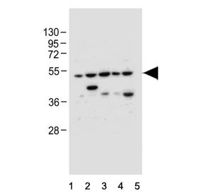 Western blot testing of human 1) HeLa, 2) U-251 MG, 3) U-87 MG, 4) U-2 OS and 5) MCF7 cell lysate wi