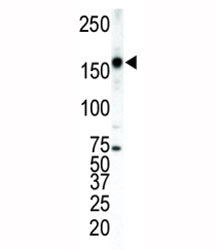 Western blot analysis of ERBB4 antibody and T47D cell lysate. Predicted molecular weight: 147-180 kD
