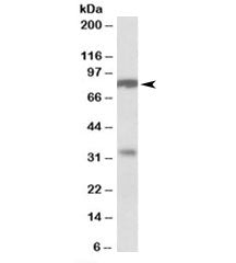 Western blot testing of human duodenum lysate with CLCA1 antibody at 1ug/ml. Predicted molecular wei