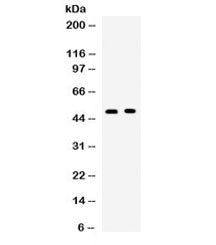 Western blot testing of human 1) SW620 and 2) 22RV1 cell lysate with OX40 antibody. Expected molecul