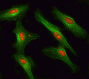RSBN1 Antibody / Round spermatid basic protein 1