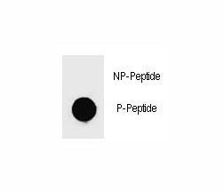 Dot blot analysis of phospho-c-Kit antibody. 50ng of phos-peptide or nonphos-peptide per dot were sp