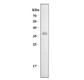 Western blot testing of rat thymus lysate with Cd7 antibody. Expected molecular weight: 25-40 kDa de