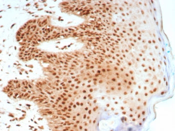IHC staining of FFPE human skin tissue with Nucleolin antibody (clone NCL/8695R). HIER: boil tissue 