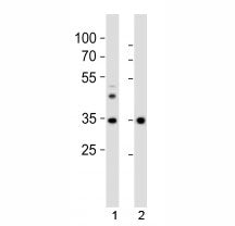 Western blot analysis of lysate from 1) human liver tissue and 2) mouse NIH3T3 cell line using Wdr5 