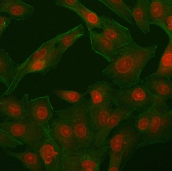 Immunofluorescent staining of FFPE human A549 cells with PHF11 antibody (red) and Phalloidin (green)