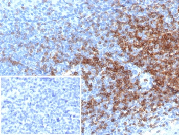 IHC staining of FFPE human tonsil tissue with CD3 epsilon antibody (clone rC3e/6966). Inset: PBS use
