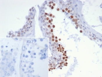 NUTM1 Antibody / NUT family member 1