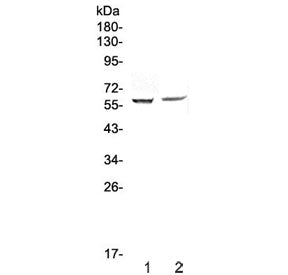 Western blot testing of human 1) HepG2 and 2) PANC-1 cell lysate with STAM1 antibody at 0.5ug/ml. Pr