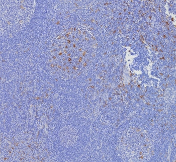 IHC staining of FFPE human tonsil tissue with CD163L1 antibody (clone CD163L1/7972). HIER: boil tiss