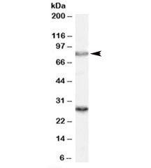 Western blot testing of rat brain lysate with SV2A antibody at 0.3ug/ml. Predicted molecular weight 