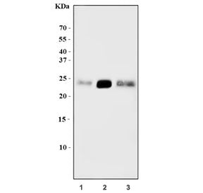 Western blot testing of 1) human HeLa, 2) rat brain and 3) mouse brain tissue lysate with ARHB antib
