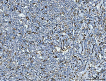 IHC staining of FFPE human lymphadenoma tissue with CD14 antibody. HIER: boil tissue sections in pH8