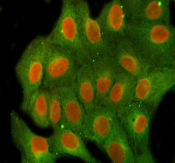 Immunofluorescent staining of FFPE human U-2 OS cells with FEN-1 antibody (red) and Beta Tubulin mAb