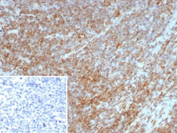 IHC staining of FFPE human tonsil tissue with Interleukin-7 antibody (clone IL7/4269). Inset: PBS us
