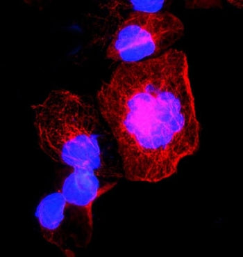 Immunofluorescent staining of FFPE human A431 cells with TUBA1A antibody (red) and DAPI nuclear stai