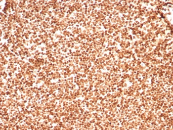 IHC staining of FFPE human lymph node tissue with Histone H1 antibody (clone rHH1/8702). HIER: boil 