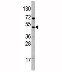 Western blot analysis of VEGFD antibody and 293 lysate. Expected molecular weight: 40-53 kDa (pro-fo