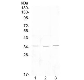 Western blot testing of 1) rat lymph, 2) rat spleen and 3) mouse thymus tissue lysate with NKG2D ant