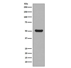 Western blot testing of human HaCat cell lysate with Cytokeratin 16 antibody. Predicted molecular we