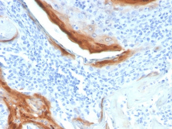 IHC staining of FFPE human tonsil tissue with IL-1RA antibody (clone IL1RA/4712). HIER: boil tissue 