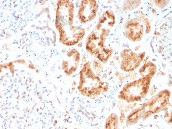 Retinol Binding Protein 4 Antibody / RBP4