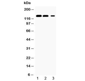 JAK1 Antibody