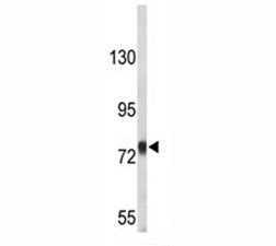Amyloid beta Precusor Protein Antibody