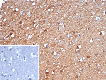 IHC staining of FFPE human brain tissue with Gamma Enolase antibody (clone ENO2/6678). Inset: PBS us