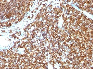 IHC testing of CD45RB antibody and FFPE human tonsil